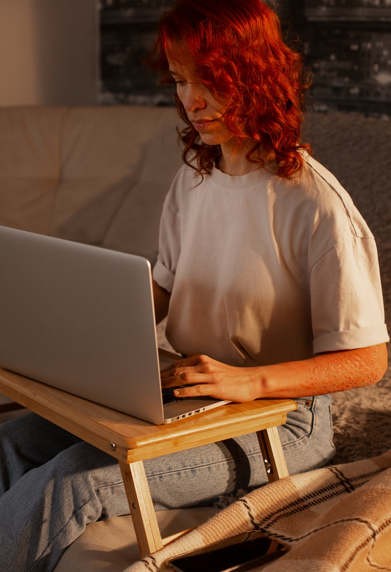 Kvinde med synlig hudlidelse, der arbejder på en bærbar computer derhjemme ved hjælp af et træbord.